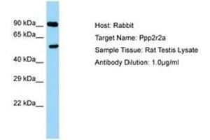 Image no. 1 for anti-Protein Phosphatase 2 Regulatory Subunit 2A (PPP2R2A) (C-Term) antibody (ABIN6750354)