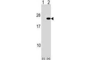 Western Blotting (WB) image for anti-Poly Binding Protein Interacting Protein 2 (PAIP2) antibody (ABIN2998979)
