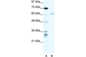 Western Blotting (WB) image for anti-IKAROS Family Zinc Finger 4 (Eos) (IKZF4) antibody (ABIN2460680) (IKZF4 抗体)