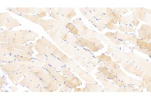 Detection of TNNC1 in Human Skeletal muscle Tissue using Polyclonal Antibody to Troponin C Type 1, Slow (TNNC1)