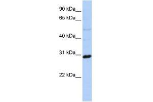 WB Suggested Anti-MTX2 Antibody Titration: 0. (MTX2 抗体  (N-Term))