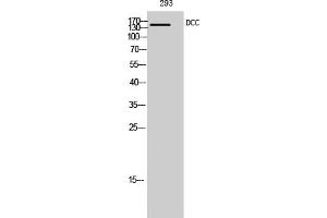 Western Blotting (WB) image for anti-Deleted in Colorectal Carcinoma (DCC) (Internal Region) antibody (ABIN5956357) (DCC 抗体  (Internal Region))