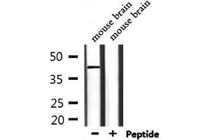 Western blot analysis of extracts from mouse brain, using CD244 Antibody. (2B4 抗体  (N-Term))