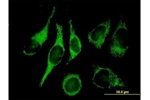 Immunofluorescence of purified MaxPab antibody to HADH2 on HeLa cell. (HSD17B10 抗体  (AA 1-261))