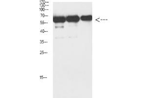 Western Blot analysis of Luciferase protein using antibody diluted at 1:1000. (Luciferase 抗体)