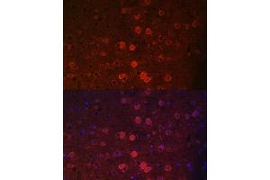Immunofluorescence (IF) image for anti-Transient Receptor Potential Cation Channel, Subfamily M, Member 2 (TRPM2) (AA 900-1000) antibody (ABIN6149582)