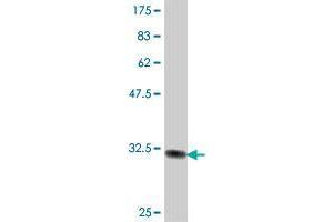 Western Blot detection against Immunogen (34. (UCK1 抗体  (AA 202-276))