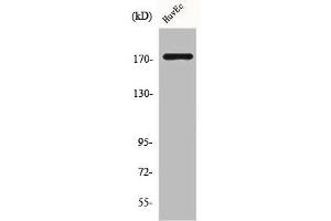Western Blot analysis of HuvEc cells using COL11A2 Polyclonal Antibody (COL11A2 抗体  (C-Term))