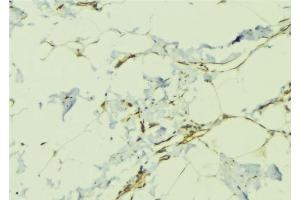 ABIN6276479 at 1/100 staining Human lung tissue by IHC-P. (TDGF1 抗体  (Internal Region))