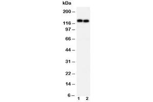 Western blot testing of N-Cadherin antibody and Lane 1:  MCF-7 (N-Cadherin 抗体  (AA 701-714))