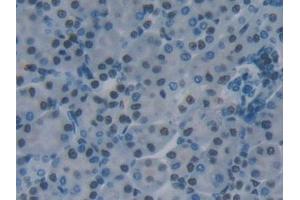 Immunohistochemistry (IHC) image for anti-KH Domain Containing, RNA Binding, Signal Transduction Associated 1 (KHDRBS1) (AA 156-381) antibody (ABIN7441811)