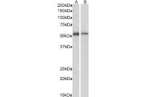 ABIN185060 (1µg/ml) staining of Human (A) and Mouse (B) Thymus lysate (35µg protein in RIPA buffer). (FAF2 抗体  (C-Term))