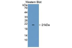 Western blot analysis of the recombinant protein. (OPA3 抗体  (AA 23-179))