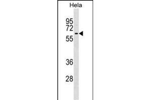 KLHL12 Antibody (C-term) (ABIN1537222 and ABIN2848955) western blot analysis in Hela cell line lysates (35 μg/lane). (KLHL12 抗体  (C-Term))
