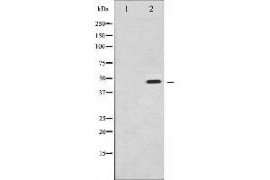 Western blot analysis of Synaptotagmin phosphorylation expression in Sobital treated 293 whole cell lysates,The lane on the left is treated with the antigen-specific peptide. (Synaptotagmin 抗体  (pSer309))