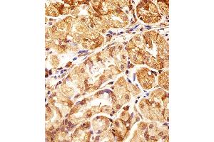 Immunohistochemistry (Paraffin-embedded Sections) (IHC (p)) image for anti-Polymerase (DNA-Directed), delta Interacting Protein 3 (POLDIP3) (AA 93-120), (N-Term) antibody (ABIN1881667)