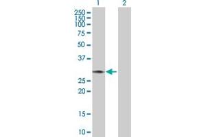Western Blotting (WB) image for anti-Peptidylprolyl Isomerase E (Cyclophilin E) (PPIE) (AA 1-301) antibody (ABIN523847)