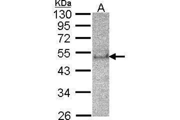 SOCS4 抗体  (C-Term)
