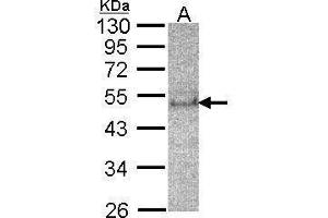 WB Image Sample(30 μg of whole cell lysate) A:HeLa S3, 12% SDS PAGE antibody diluted at 1:200 (SOCS4 抗体  (C-Term))