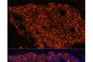 Immunofluorescence (IF) image for anti-Surfactant Protein C (SFTPC) antibody (ABIN7259843)