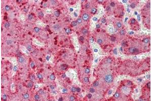Human Liver (formalin-fixed, paraffin-embedded) stained with ALPL antibody ABIN462352 followed by biotinylated anti-mouse IgG secondary antibody ABIN481714, alkaline phosphatase-streptavidin and chromogen. (ALPL 抗体)