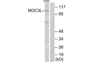 Western Blotting (WB) image for anti-Nucleolar Complex Associated 3 Homolog (NOC3L) (Internal Region) antibody (ABIN6300703) (NOC3L 抗体  (Internal Region))