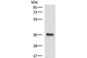 Western blot analysis of Mouse liver tissue lysate using GRHPR Polyclonal Antibody at dilution of 1:900 (GRHPR 抗体)