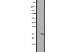 Western blot analysis of FGF17 expression in 721_B cell lysate ,The lane on the left is treated with the antigen-specific peptide. (FGF17 抗体  (Internal Region))