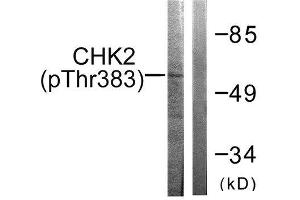 Western Blotting (WB) image for anti-Checkpoint Kinase 2 (CHEK2) (pThr383) antibody (ABIN1847337) (CHEK2 抗体  (pThr383))