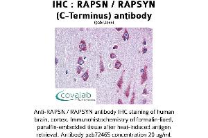 Image no. 1 for anti-Receptor-Associated Protein of The Synapse (RAPSN) antibody (ABIN1738731) (RAPSN 抗体)