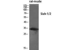 Western Blot (WB) analysis of specific cells using Siah-1/2 Polyclonal Antibody. (SIAH1/2 抗体  (Internal Region))