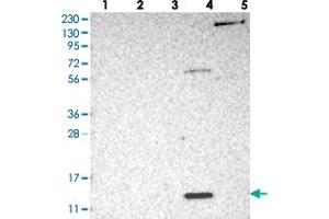 Western blot analysis of Lane 1: RT-4, Lane 2: U-251 MG, Lane 3: Human Plasma, Lane 4: Liver, Lane 5: Tonsil with PSMG3 polyclonal antibody . (PSMG3 抗体)