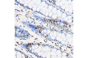 Immunohistochemistry of paraffin-embedded Human colon using ZNF263 Rabbit pAb (ABIN7271472) at dilution of 1:100 (40x lens). (ZNF263 抗体  (AA 120-240))