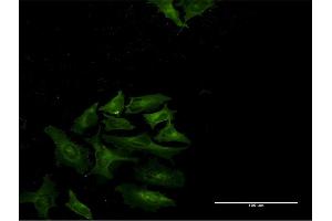 Immunofluorescence of monoclonal antibody to STAT4 on HeLa cell. (STAT4 抗体  (AA 1-748))