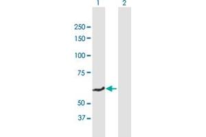 Western Blotting (WB) image for anti-Solute Carrier Family 40 (Iron-Regulated Transporter), Member 1 (SLC40A1) (AA 1-571) antibody (ABIN949253)