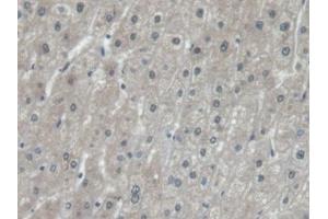 Detection of EEF1a1 in Human Liver Tissue using Polyclonal Antibody to Eukaryotic Translation Elongation Factor 1 Alpha 1 (EEF1a1) (eEF1A1 抗体  (AA 1-241))