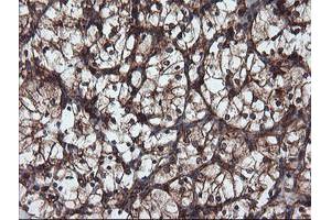 Image no. 7 for anti-Ubiquitin Specific Peptidase 9, X-Linked (USP9X) (AA 2246-2570) antibody (ABIN1491228)