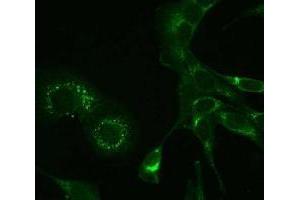 Immunofluorescence (IF) image for anti-MHV NSP9 antibody (ABIN400814) (MHV NSP9 抗体)