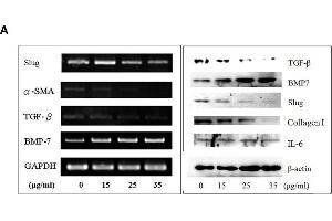 Western Blotting (WB) image for anti-Actin, alpha 2, Smooth Muscle, Aorta (ACTA2) (N-Term) antibody (ABIN2857027)