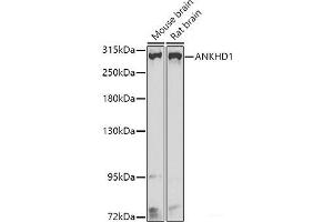 Western blot analysis of extracts of various cell lines using ANKHD1 Polyclonal Antibody at dilution of 1:1000. (ANKHD1 抗体)