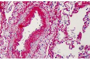 Human Lung: Formalin-Fixed, Paraffin-Embedded (FFPE) (Elastin 抗体)