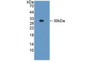 Detection of Recombinant PARK2, Human using Polyclonal Antibody to Parkinson Disease Protein 2 (PARK2) (Parkin 抗体  (AA 229-465))