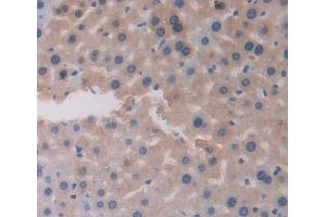 Used in DAB staining on fromalin fixed paraffin- embedded Kidney tissue (CHRNA4 抗体  (AA 32-249))