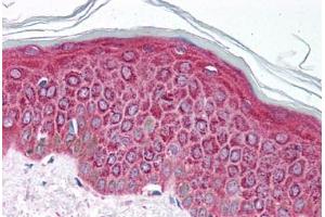 Human Skin (formalin-fixed, paraffin-embedded) stained with ETV4 antibody ABIN214103 at 5 ug/ml followed by biotinylated goat anti-rabbit IgG secondary antibody ABIN481713, alkaline phosphatase-streptavidin and chromogen. (ETV4 抗体  (AA 181-230))