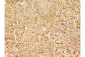 ABIN6261354 and ABIN6266951 at 1/100 staining human normal liver tissue by IHC-P. (DOK7 抗体  (C-Term))