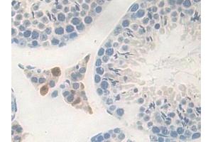 Immunohistochemistry (IHC) image for anti-Carboxypeptidase B1 (Tissue) (CPB1) (AA 109-415) antibody (ABIN7441850)