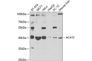Western blot analysis of extracts of various cell lines, using  antibody (ABIN6131166, ABIN6136417, ABIN6136418 and ABIN6223845) at 1:1000 dilution. (ACAT2 抗体  (AA 1-97))