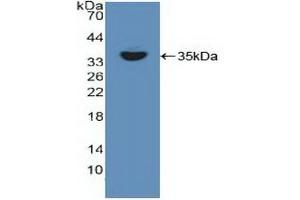 Detection of Recombinant RELB, Human using Polyclonal Antibody to V-Rel Reticuloendotheliosis Viral Oncogene Homolog B (RELB) (RELB 抗体  (AA 248-492))