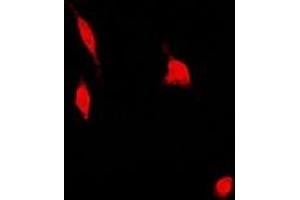 Immunofluorescent analysis of PSMA4 staining in U2OS cells. (PSMA4 抗体)