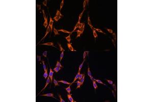 Immunofluorescence analysis of NIH/3T3 cells using KRAS antibody (ABIN3021676, ABIN3021677, ABIN3021678, ABIN1513137 and ABIN1514282) at dilution of 1:100. (K-RAS 抗体)